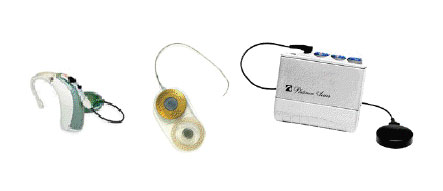Cochlear Implant by Advanced Bionics Corporation