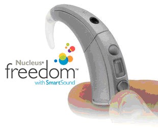 Picture of Cochlear Corporation cochlear implant