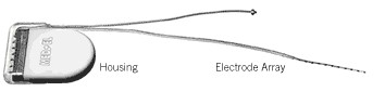 MED-EL cochlear implant